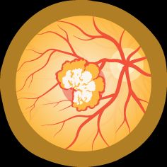 an illustration of an eye with a yellow flower